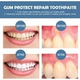 thumbnail image 3 of Banzch Gum Protect Repair Toothpaste, 3pc Tooth Repair Toothpaste with Brightening Formula, Helps Clean Stains, Reduce Swelling Gums, Fresh Breath Oral Care 90ml, 3 of 7