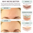 thumbnail image 4 of Kit de parches faciales Dermaclara antiarrugas con frente y cuello, 4 of 7