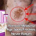 thumbnail image 2 of Crema blanqueadora para pecas, eliminador de Melasma, manchas oscuras, eliminación de melanina, eliminador de Melasma, hidratante, ilumina la cara, cuidado de la piel"10 PCS" Fivean LED, 2 of 2