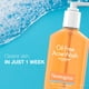thumbnail image 5 of Limpiador facial Neutrogena, jabón para el acné sin aceite, 270 ml, paquete de 6, 5 of 8
