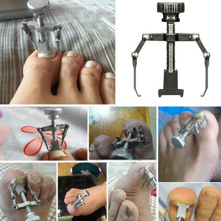 Ingrown Toe Nail Recover Correction Tool Pedicure Toenail Fixer Foot Nail