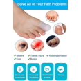 thumbnail image 5 of BRILLAR Protectores de dedos de gel suave y transpirable (12 piezas) - Blanco, tapones para los dedos del pie para el dedo gordo, alivio del dolor y tubos de cojín de fricción, 5 of 5