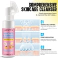 thumbnail image 5 of Aliver Kojic Acid & Turmeric Mousse Cleanser-Turmeric Facial Cleanser for Brightens Skin Tone & Cleans Pores-Turmeric Foaming Cleanser for All Skin Types,3 Pack, 5 of 10