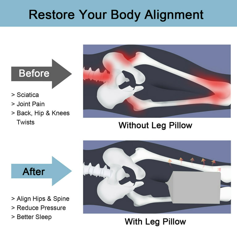 RenoSleep™ - Leg & Knee Support Pillow for Side Sleepers – Reliff