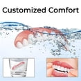 thumbnail image 3 of Customized Clear Dental Aligner Set for Teeth Straightening and Invisible Comfort Fit, 3 of 7