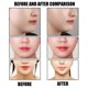 thumbnail image 5 of Rollo de cinta reductora de arrugas para levantar la belleza de la cinta de kinesiología facial (naranja) Tmvgtek Cuidado Belleza, 5 of 7
