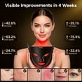 thumbnail image 2 of Morfone Red Light Therapy for Face, 4 Modes Led Face Mask Light Therapy with Remote, Portable Light Therapy Mask for Skin Care at Home, Travel (Black), 2 of 9