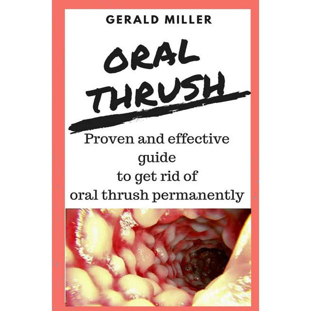How To Treat Oral Thrush Oral Thrush Premium Candida Cleanse Yeast