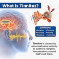 thumbnail image 4 of Tinnitus Relief Device, 2023 New Tinnitus Relief For Ringing Ears-device, Tinnitus Relief Device, Tinnitus Treatment Stop Ear Ringing, Tinnitus Ear C, 4 of 5