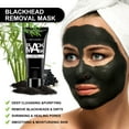 Huge Blackhead Removal - 4rnkc36