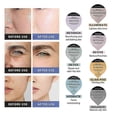 thumbnail image 2 of 2026 HaKeLai Hydrate Detox Illuminate Glam Revive Capsule Pods Serum Facial SPA Serum For Facial Aqua CO2 Oxygen Bubble Beauty Machine Gel, 2 of 4
