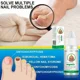 thumbnail image 4 of Hongos Extra para uñas, cuidado de reparación de uñas, eliminación de hongos para dedos de los pies, antiinfección, nuevo, 4 of 5