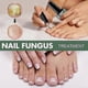 thumbnail image 3 of 15ml Fungal Nail Treatment Liquid Highly Effective Kills Toe Nail Fungus 2pcs, 3 of 5