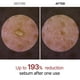 thumbnail image 3 of Ampolla exfoliante Dr. Melaxin Peel Shot Glow de arroz blanco, 80 ml, 3 of 8