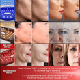 thumbnail image 4 of Red Light Therapy for Face | LED Light Therapy Mask with 4 Colors from 240 LED individually controlled | Infrared Wireless Treatment Skincare Face Mask for Home use and Travel, 4 of 7