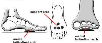 pedag deluxe metatarsal insoles