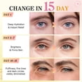thumbnail image 6 of Devimic Under Eye Patches Set 60 Pairs (2 x 30 pairs), Golden & Rose Eye Mask for Dark Circles & Puffiness, Hydrating, Firm & Brighten Delicate Skin, 6 of 8