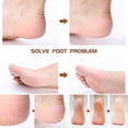 thumbnail image 4 of Pedicure Kit Stainless Steel Foot Files For Hard Skin Remover, 4 of 5