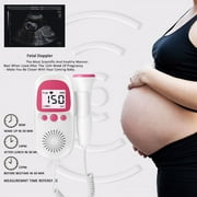 Heartbeat Monitor