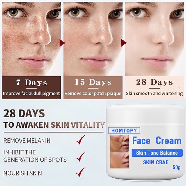 Fiudx Ofertas De La Semana Crema Aclaradora Para Moteado Facial, 50G, Crema Hidratante Para La Piel Con Moteado De Melasma, Crema Ot De Belleza Con Moteado
