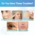 thumbnail image 5 of Suero antienvejecimiento para mujer, eliminador de arrugas, aumento de colágeno, cuello, líneas faciales, antiarrugas, Lifting, reafirmante, cuidado de la piel Facial, 5 of 5