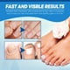 thumbnail image 3 of Bolígrafo de reparación de luz azul, bolígrafo antihongos para el cuidado de las uñas, herramienta de uñas indolora para onicomicosis Ygjytge Cuidado Belleza, 3 of 4