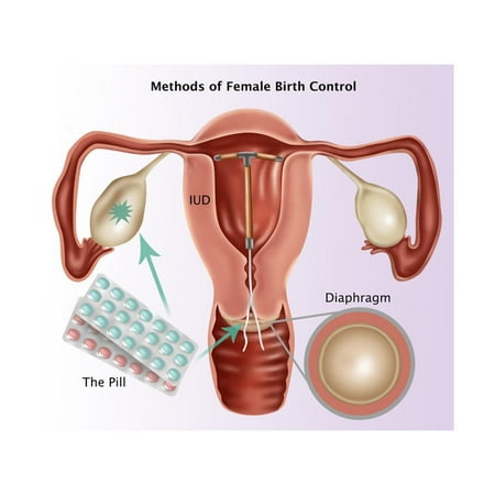Methods of Female Birth Control Print Wall Art By Gwen