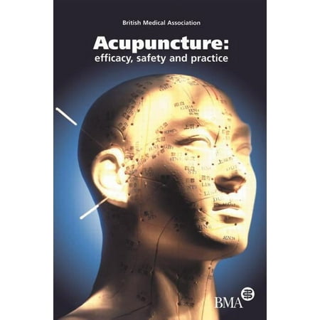 UPC: 9789058231642 | Acupuncture: Efficacy  Safety and Practice (Paperback)