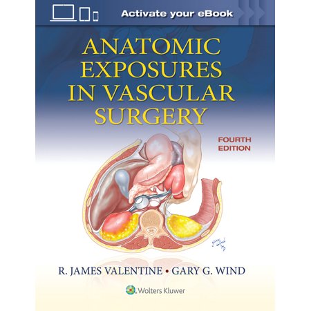 UPC: 9781975152765 | Anatomic Exposures in Vascular Surgery (Hardcover)
