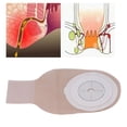 thumbnail image 1 of Ostomy Pouch, Portable  Colostomy Bag  for Ileostomy Stoma Care, 1 of 8