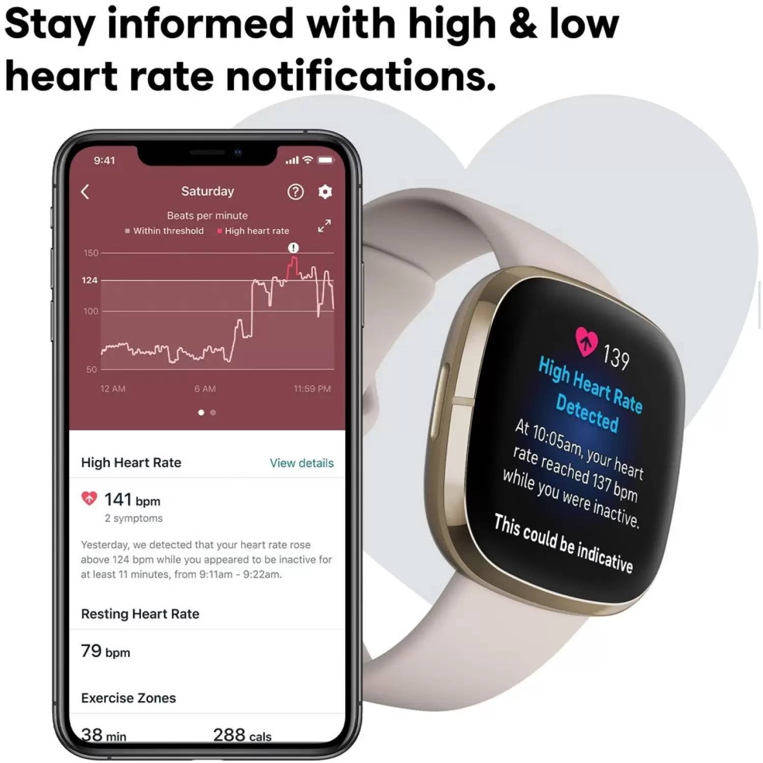 Open Box Fitbit - Sense Advanced Health Smartwatch - Soft Gold / Lunar White