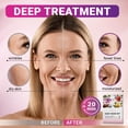 thumbnail image 2 of Mascarillas faciales en láminas VIABEAUTY Colágeno con ácido hialurónico, paquete de 24, 2 of 6