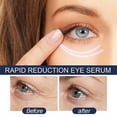 thumbnail image 5 of 2pcs Anti-wrinkle Eye Cream Instant Anti Aging Eye Care Remove Eye Bags Puffiness Lift Firm Brightening Dark Circles Cream For Eye, 5 of 5