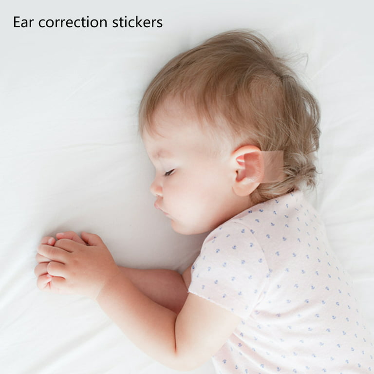 Otostick Baby - 8 Count Discreet Protruding Ear Corrector for Babies- NEW