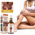 thumbnail image 2 of Suero Blanqueador Aceite Aclarante para Manchas Oscuras en Cuerpo y Nudillos Piel Negra Rodillas y C, 2 of 7