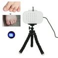 thumbnail image 4 of Cure Onychomycosis Treatment Machine, Toe Finger Nail Treatment Machine Produce Uniform Light Whitening Toe Nail Skin Solving Nail Problems  For Home Use, 4 of 8