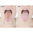 thumbnail image 7 of Steel tongue scraper for oral hygiene, gentle cleaning tool to remove debris and promote fresh breath, anti-rust design, easy to use, 7 of 7