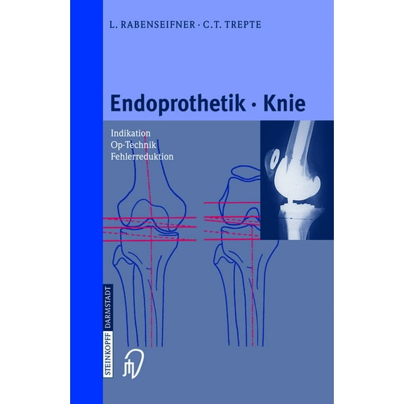 Endoprothetik Knie, (Hardcover)