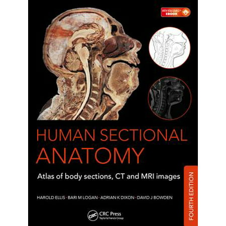 Human Sectional Anatomy: Atlas of Body Sections, CT and MRI Images, Fourth Edition