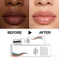thumbnail image 2 of Dark Lips Brightening Cream Deep Moisturizing With Extracts Lip Softening Fade Lip Lines Daily Liprepair Use For Sensitive 20g, 2 of 8
