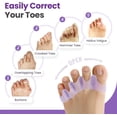 thumbnail image 3 of Promifun Toe Separators, 8 Pack Bunion Corrector for Women/Men, Soft Toe Spacers with Lavender Extract - Dividers to Correct Bunions, Hammertoes, Overlapping Toes (Lavender), 3 of 7