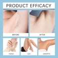 thumbnail image 3 of Fiudx Crema Depilatoria, Fórmula Suave para Pieles Suaves, Crema Corporal No Irritante, Efecto Seda de Larga Duración, Ideal para Pieles Sensibles, Solución para Estilos de Vida Ajetreados, 120 G, 3 of 7