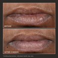 thumbnail image 4 of Bálsamo para labios Lip Therapy Perricone MD Cold Plasma Plus+ Black, 4 of 8