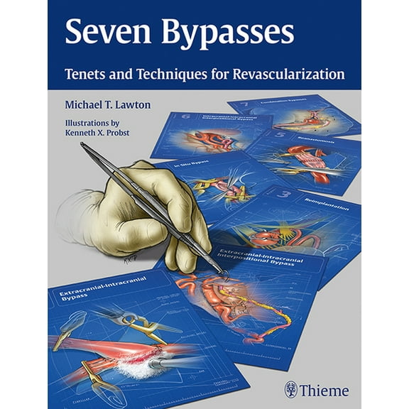 Seven Bypasses: Tenets and Techniques for Revascularization (Hardcover)