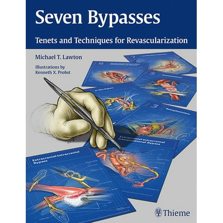 UPC: 9781626234833 | Seven Bypasses: Tenets and Techniques for Revascularization (Hardcover)