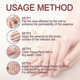 thumbnail image 4 of Soothing Antifungal Foot Oil for Nail Repair & Whitening 10ml Pedicure Essential Solution Inner Care Tool Fungal Relief Treatment, 4 of 5
