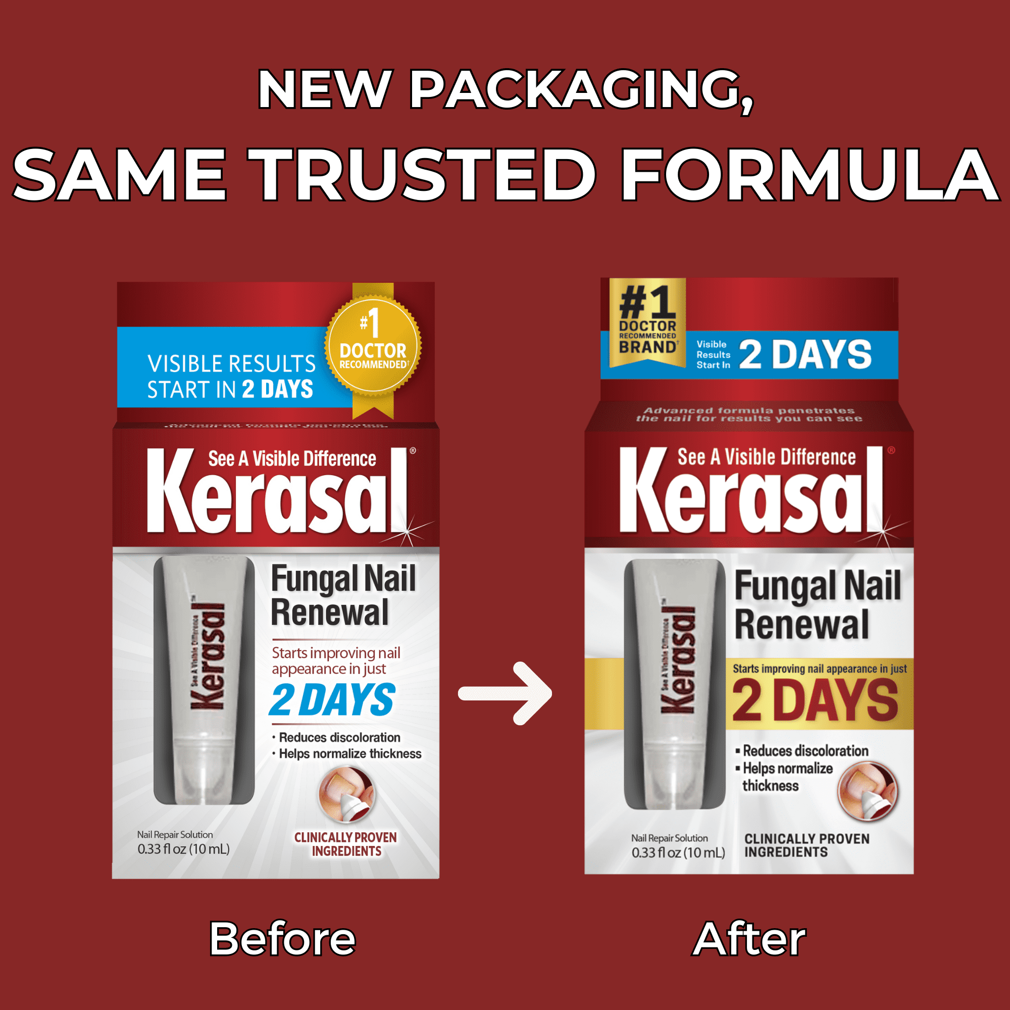 (2 pack) Kerasal Nail Fungus Extra Strength | Restorative Nail Repair for Damaged Nails, 0.33 fl oz