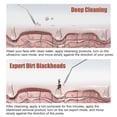 thumbnail image 5 of Depurador de piel ultrasónico de belleza, limpiador Facial, eliminador de espinillas, máquina limpiadora Facial, cuidado de la piel, masajeador de acné, Lifting Facial kaili Sencillez, 5 of 5