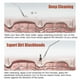 thumbnail image 5 of Depurador de piel ultrasónico de belleza, limpiador Facial, eliminador de espinillas, máquina limpiadora Facial, cuidado de la piel, masajeador de acné, Lifting Facial kaili Sencillez, 5 of 5