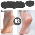 thumbnail image 2 of Vocoste Sandpaper Disk Replacement Pad Foot File Callus Remover Tool Medium 150 Grit 35mm 100 Pcs, 2 of 7